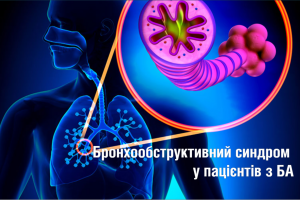 Бронхообструктивний синдром у пацієнтів з БА